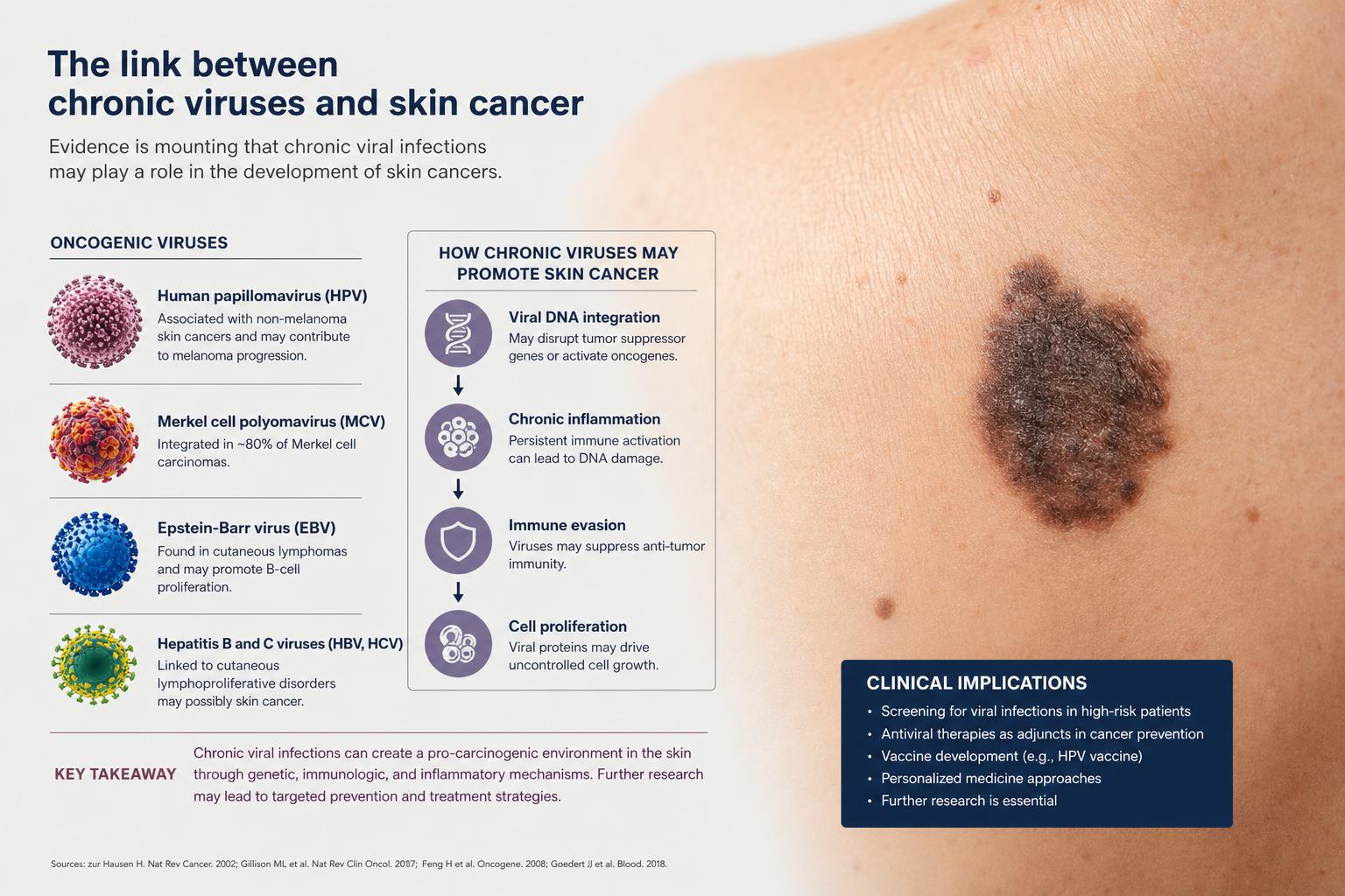 Хронические вирусы и рак кожи мифы факты и реальная биологическая связь
